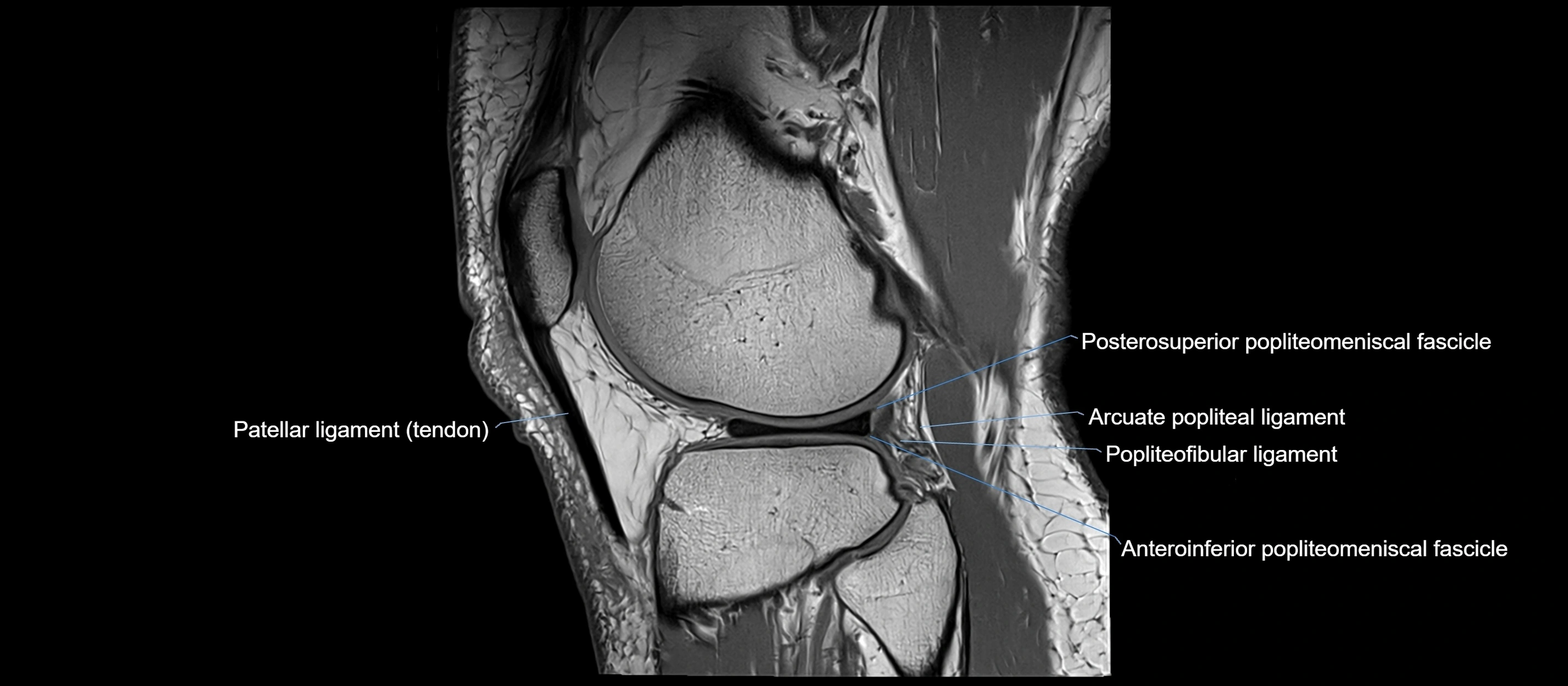 MRI sagittal  ligaments cross sectional anatomy 3T  radiology  image-img-00001-00037.webp